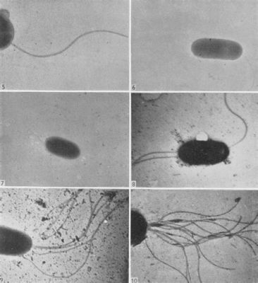  Chilodonella: Een microscopische kampioen in de wereld van flagellen!