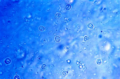 Cryptosporidium! Een microscopisch parasiet die zich thuisvoelt in de darmen van dieren